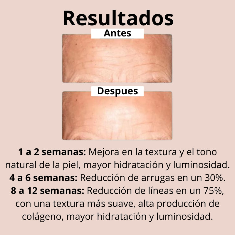 Kit Limpiador Y Tónico Con Ácido Glicólico - Grasa Y Poros